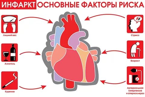 Причины инфаркта миокарда, подозрение на инфаркт, необычные признаки
