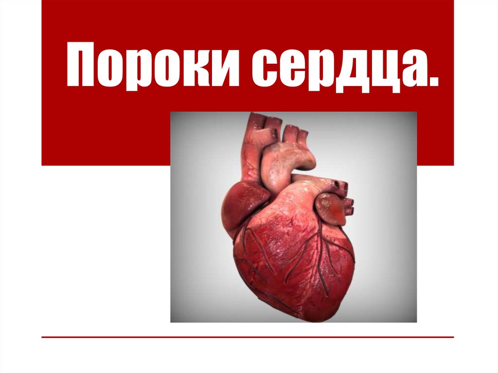 Пороки сердца: понятие, классификация, патогенез